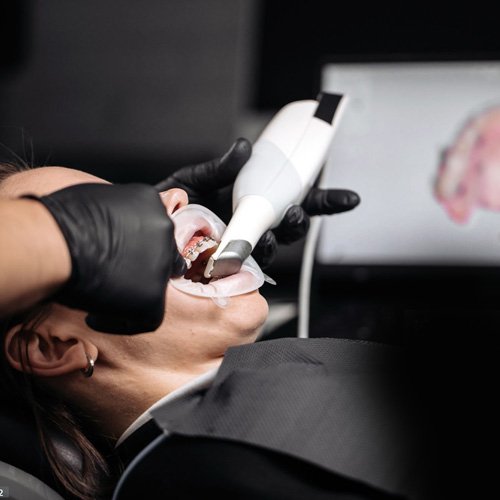 Onde fazer scanner intraoral para casos odontológicos em Fazenda Rio Grande?