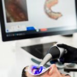 Scanner intraoral: quando vale a pena escanear no paciente?